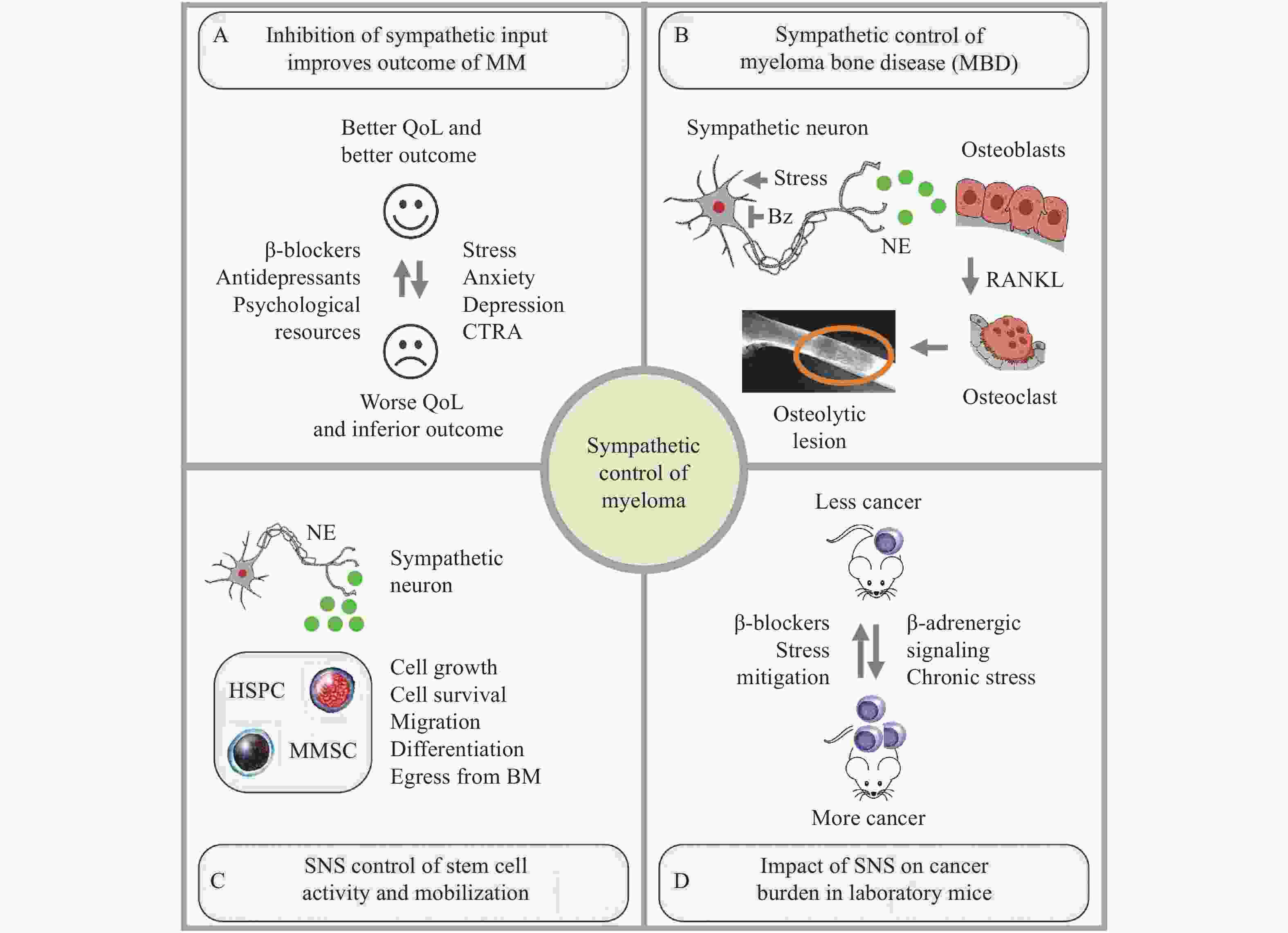 impact-of-the-sympathetic-nervous-system-on-multiple-myeloma